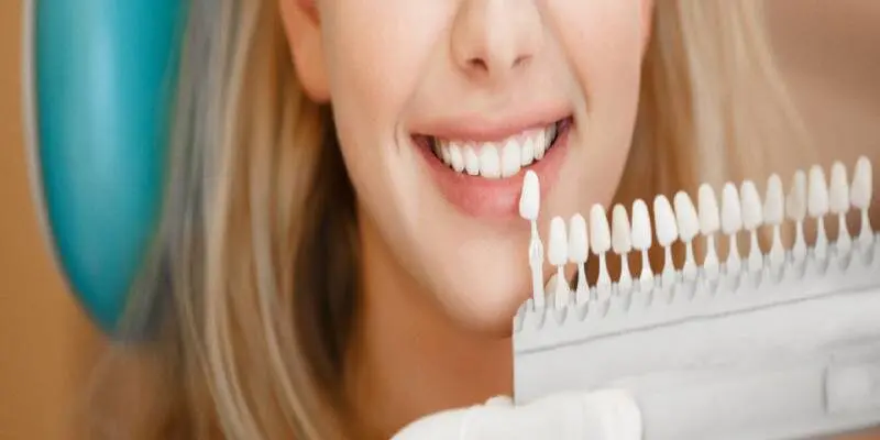 Teeth-Whitening-Banner