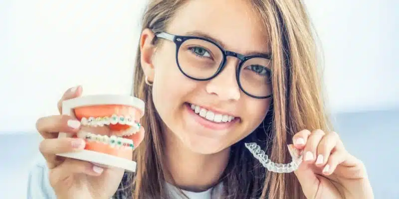 Which Type Of Braces Are Best For You