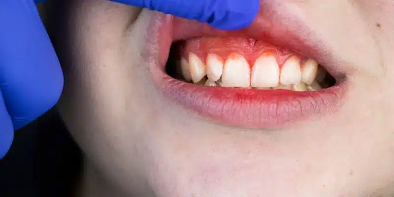 What is the Role of the Periodontal Specialist