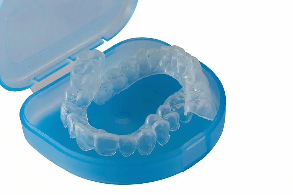 Everything You Need to Know About Invisalign Dentists_1