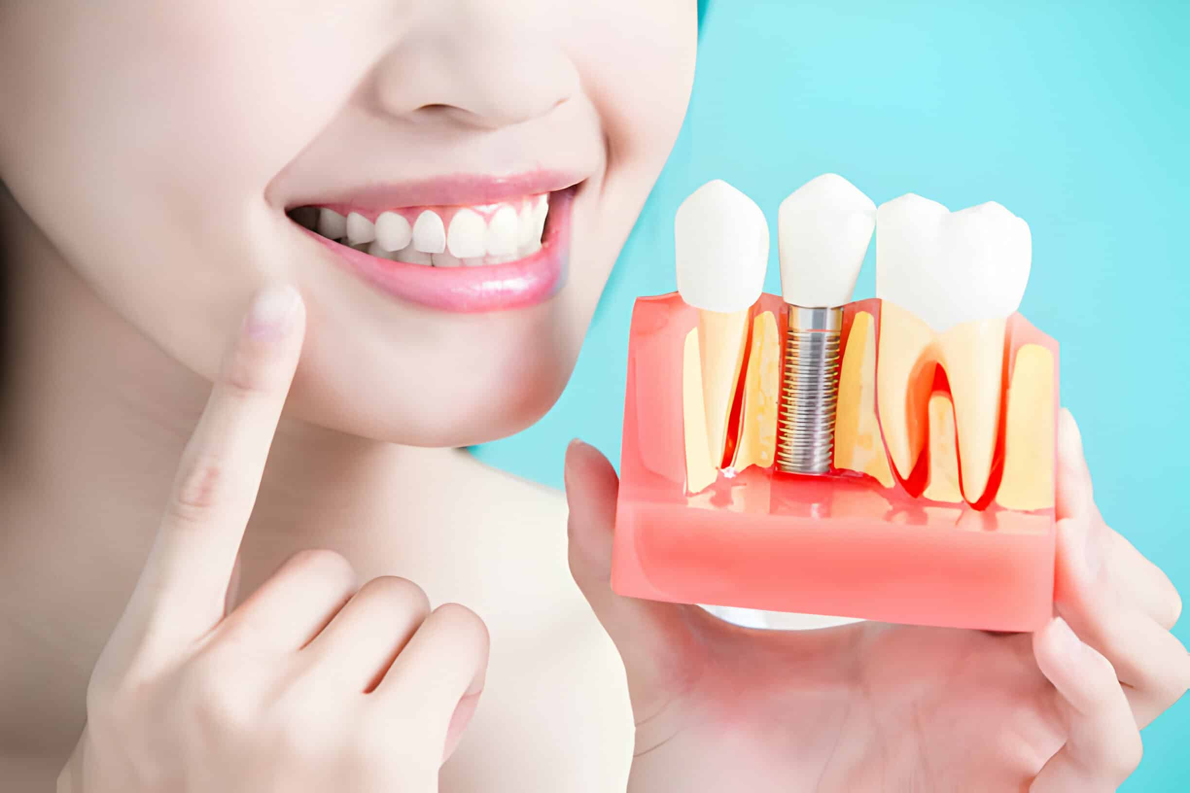 Dental Implants: A Long-Term Investment in Your Oral Health_2
