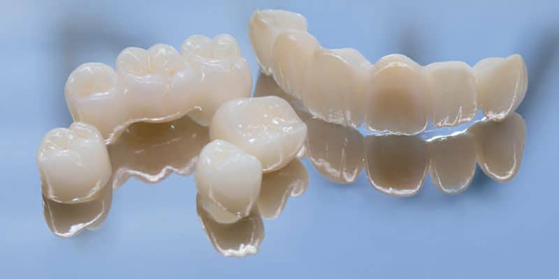 Transform Your Smile with Dental Crowns: Expert Tips and Insights_FI