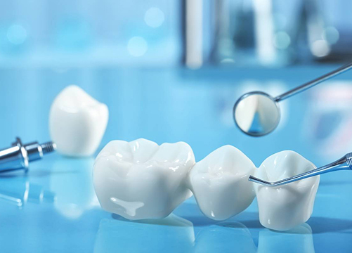 Loves Park Family Dental: Leading Crown Replacement Services in Loves Park, Illinois