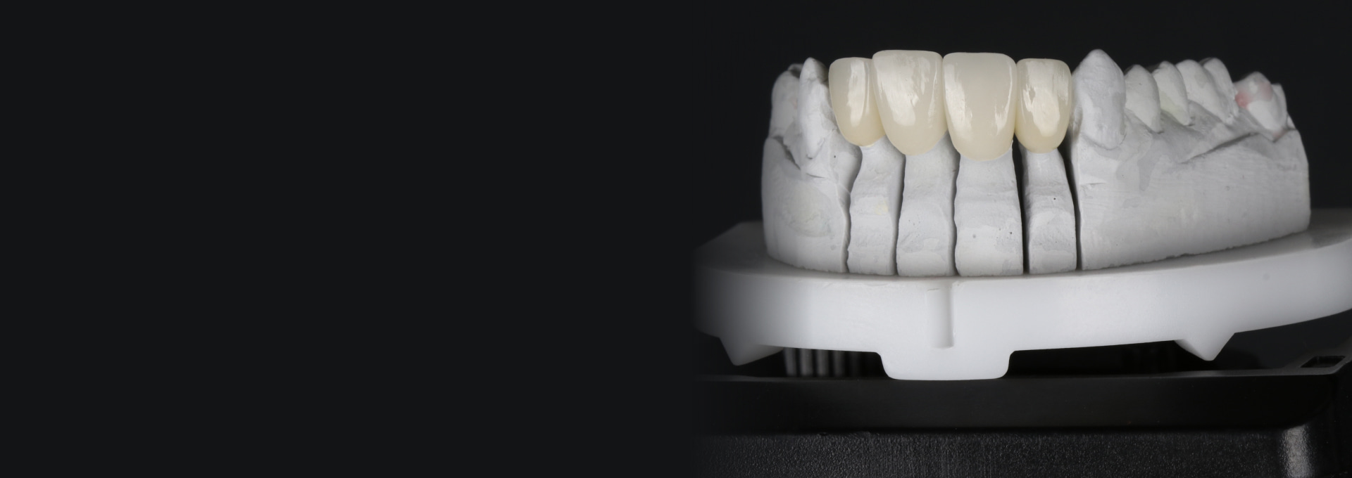 Dental Bridges Banner Image