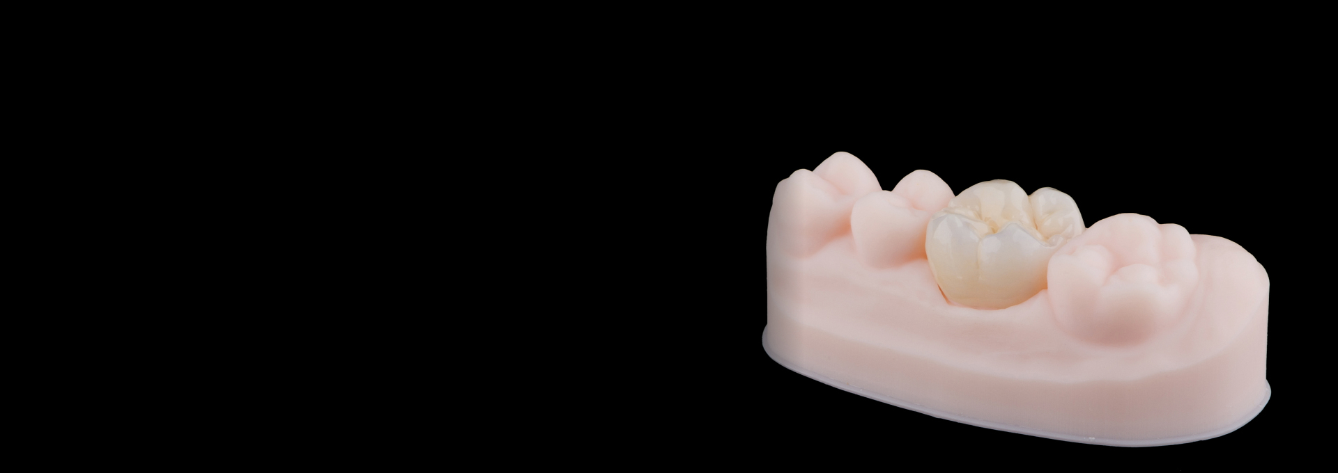 Dental Crowns Banner Image