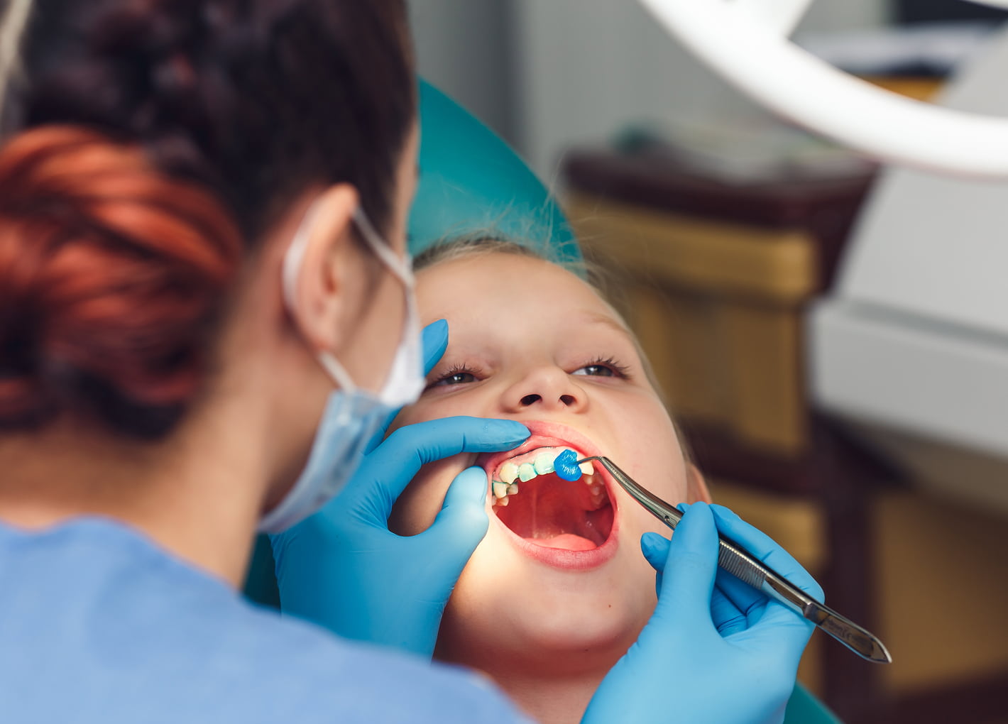Child receiving fluoride treatment at the dentist