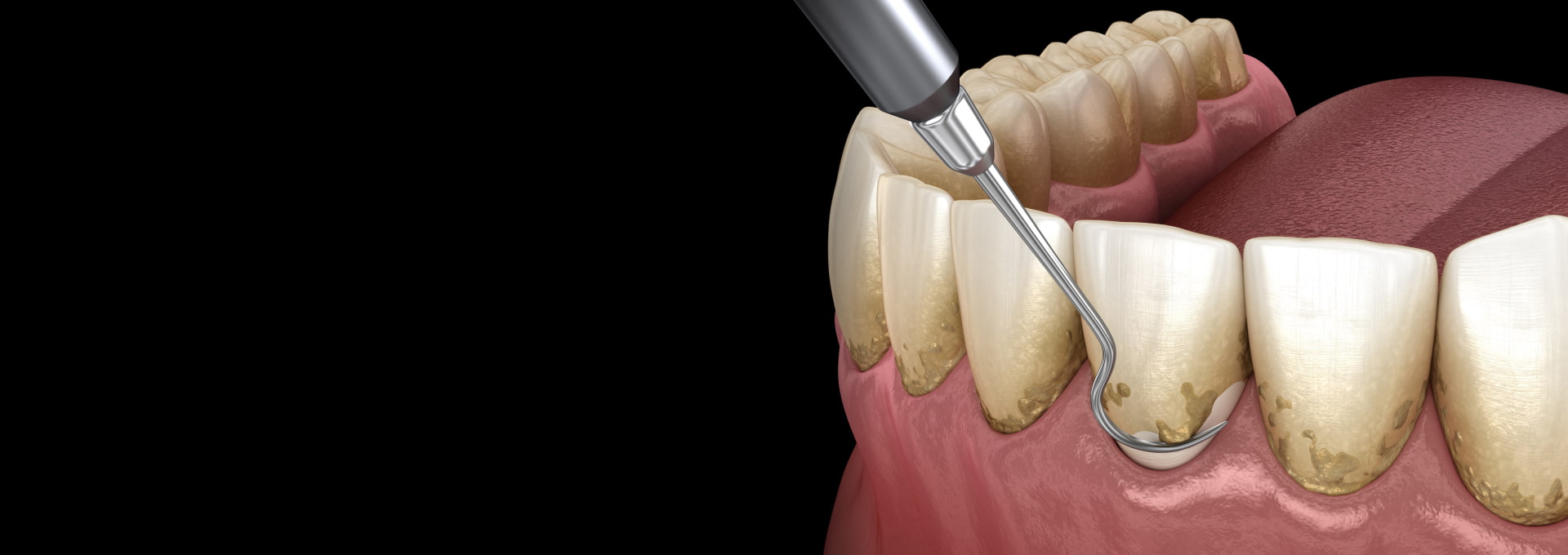 Periodontal Care Banner Image