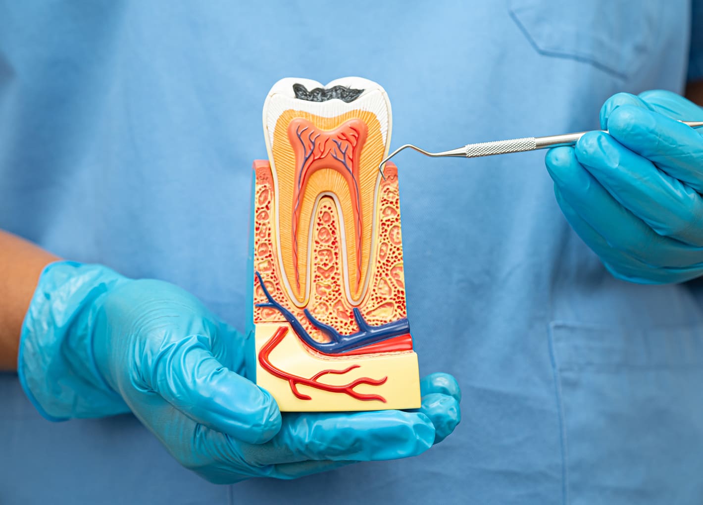 Dentist performing a root canal procedure on a patient