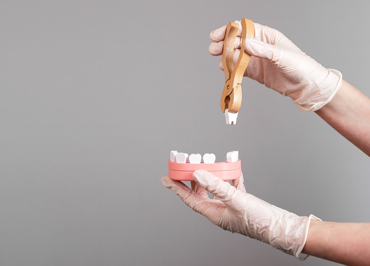 Tooth Extractions