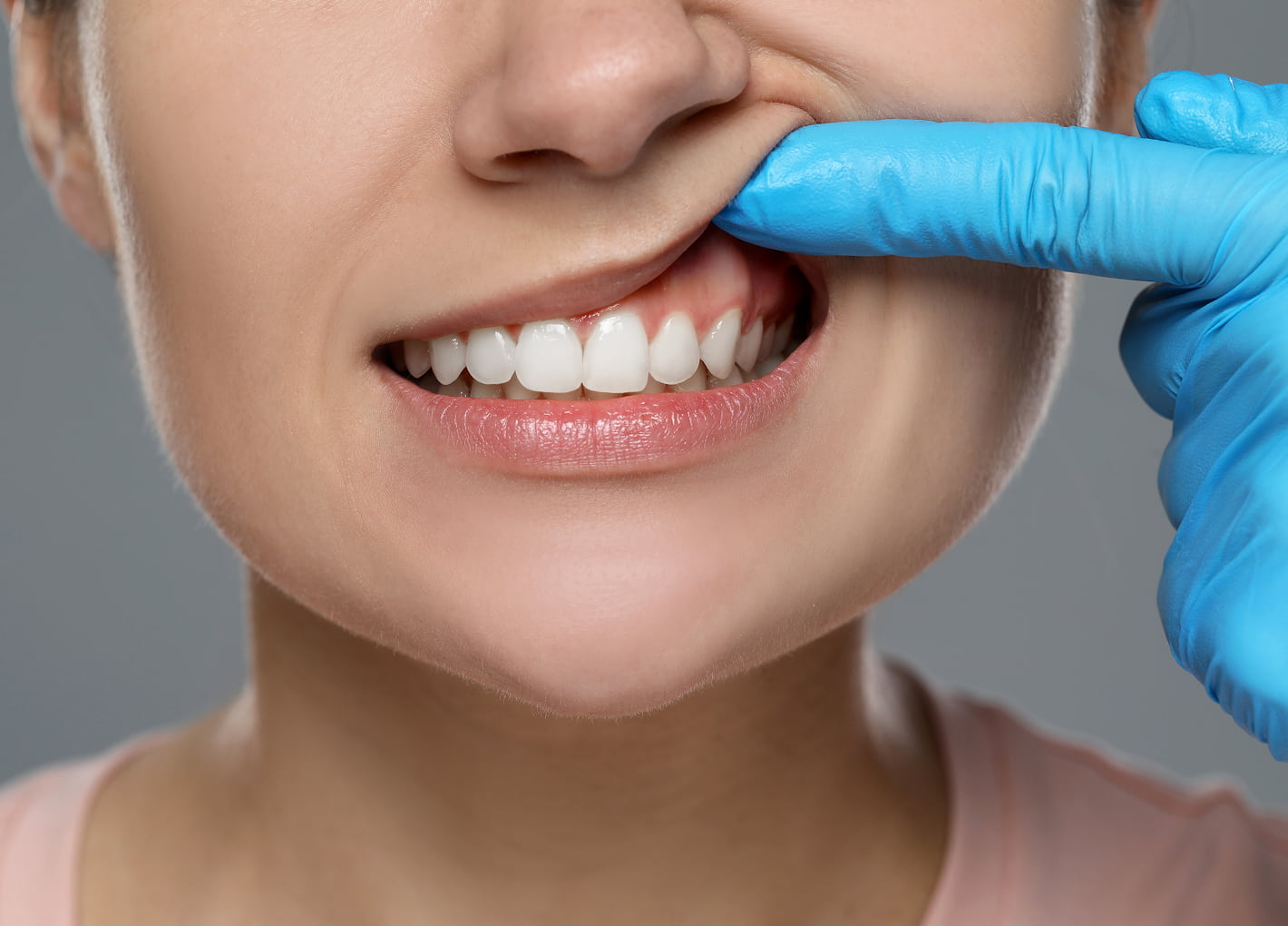 Periodontal Care